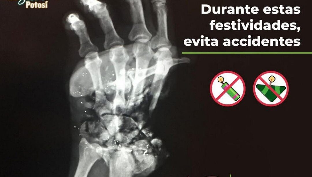 CONTINÚAN ACCIONES DE PREVENCIÓN DE ACCIDENTES POR USO DE PIROTECNIA