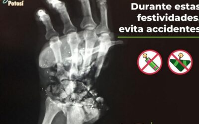 CONTINÚAN ACCIONES DE PREVENCIÓN DE ACCIDENTES POR USO DE PIROTECNIA