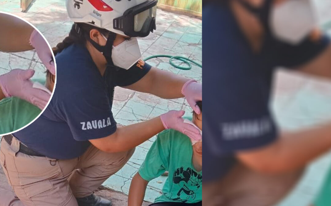 SALVAJE INDIVIDUO ARROJÓ ÁCIDO A UN MENOR DE EDAD EN CD. FERNÁNDEZ